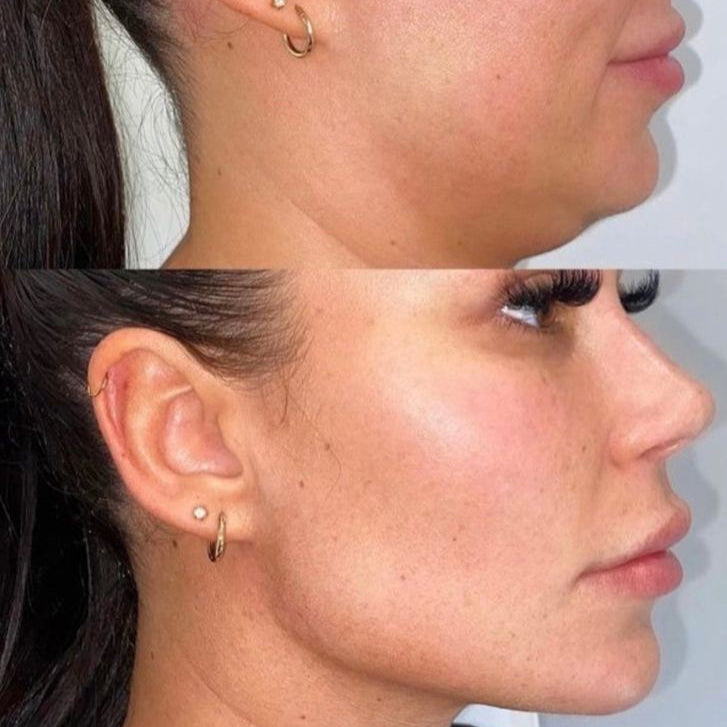 Close-up of a person's ear with earrings on a plain background